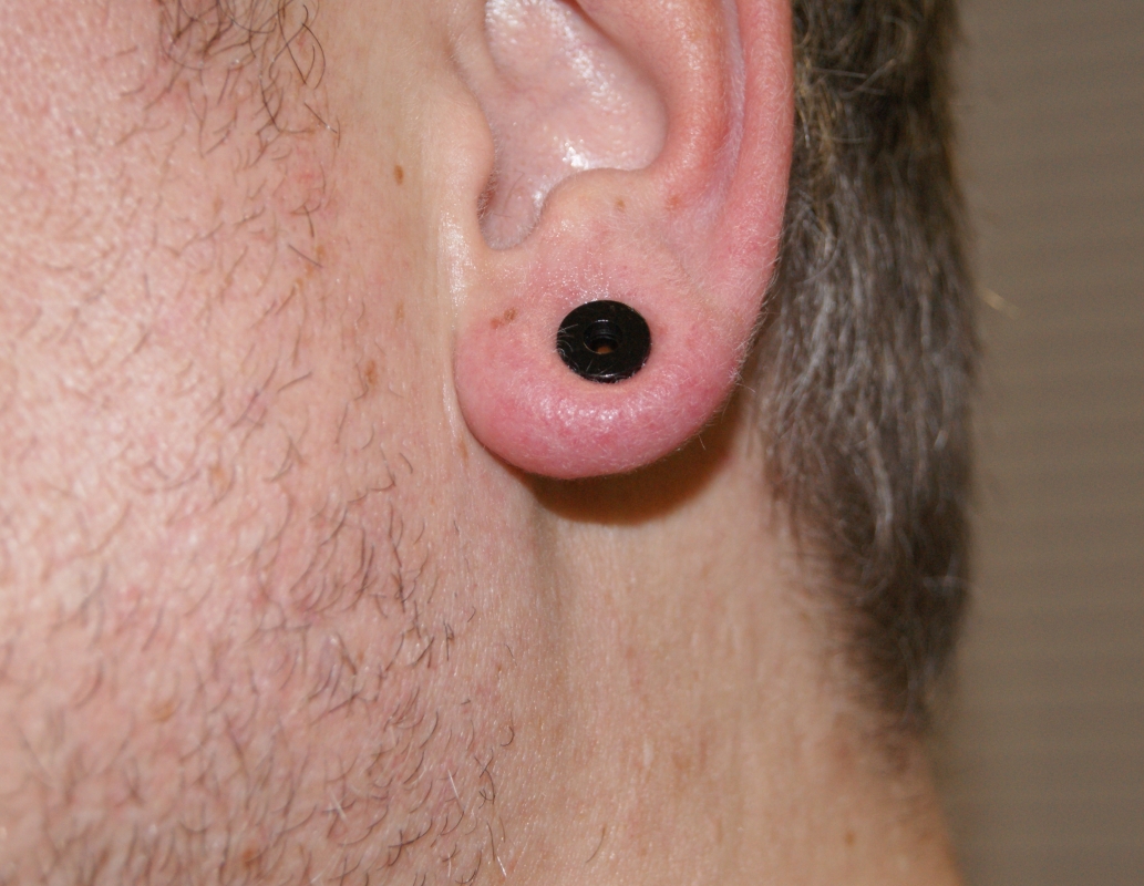 Piercingarten und Preise PiercIn